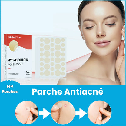 Parche Antiacné Original (144 parches)