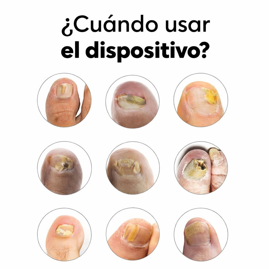 Uña Vital – Cuidado de uñas fuertes y saludables