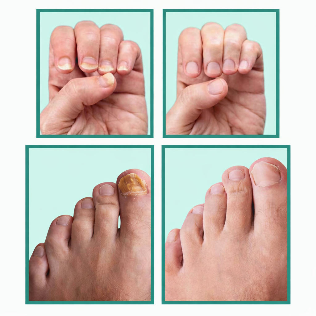 Uña Vital – Cuidado de uñas fuertes y saludables